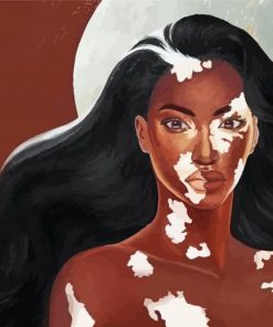 Beautiful Vitiligo Woman Art Diamond Painting