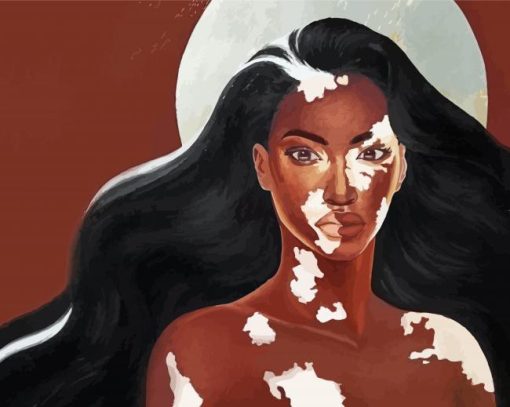 Beautiful Vitiligo Woman Art Diamond Painting
